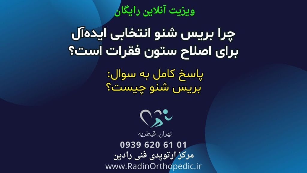 بریس شنو چیست