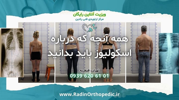 اسکولیوز - همه چیز درباره اسکولیوز