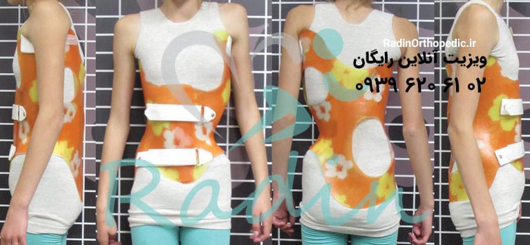 بریس شنو برای درمان ستون فقرات