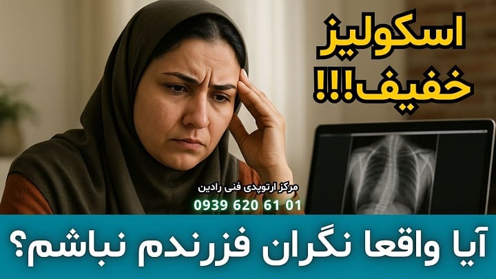 آشنایی کامل با اسکولیوز خفیف در کودکان