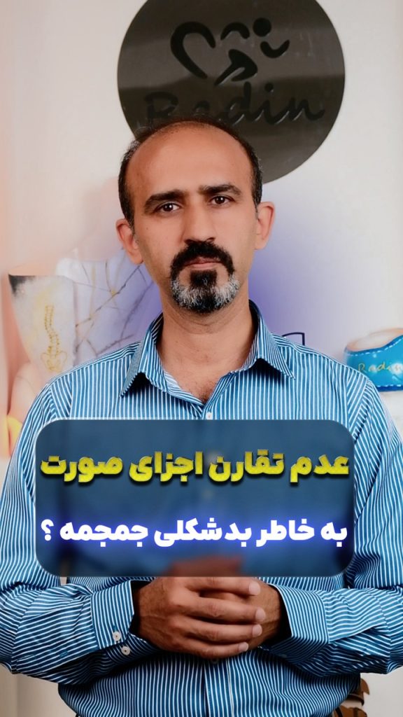 عکس نشان‌دهنده عدم تقارن صورت نوزاد به عنوان نشانه بدشکلی جمجمه