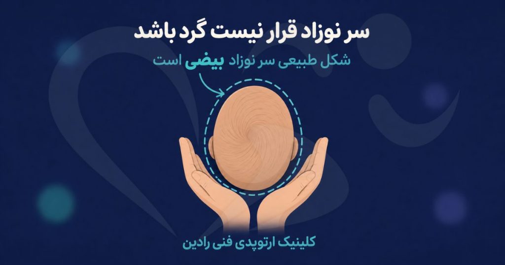 شکل طبیعی سر نوزاد از نمای بالا، بیضی است نه دایره کامل