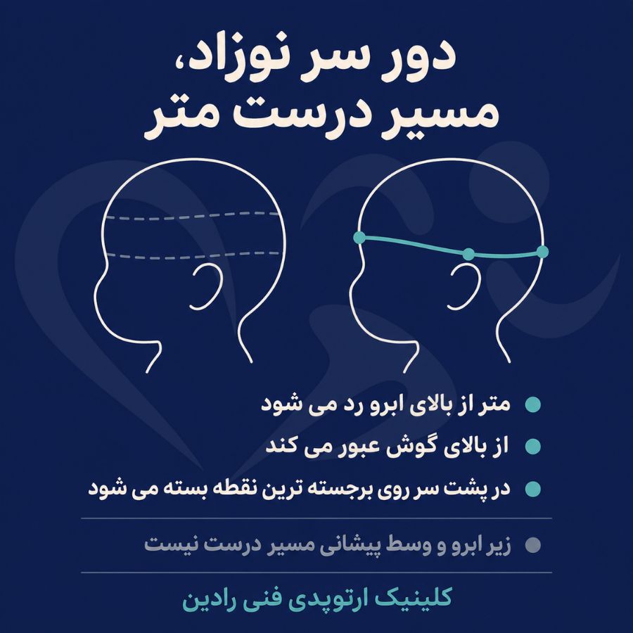 مسیر درست متر برای اندازه گیری دور سر نوزاد و حالت های نادرست