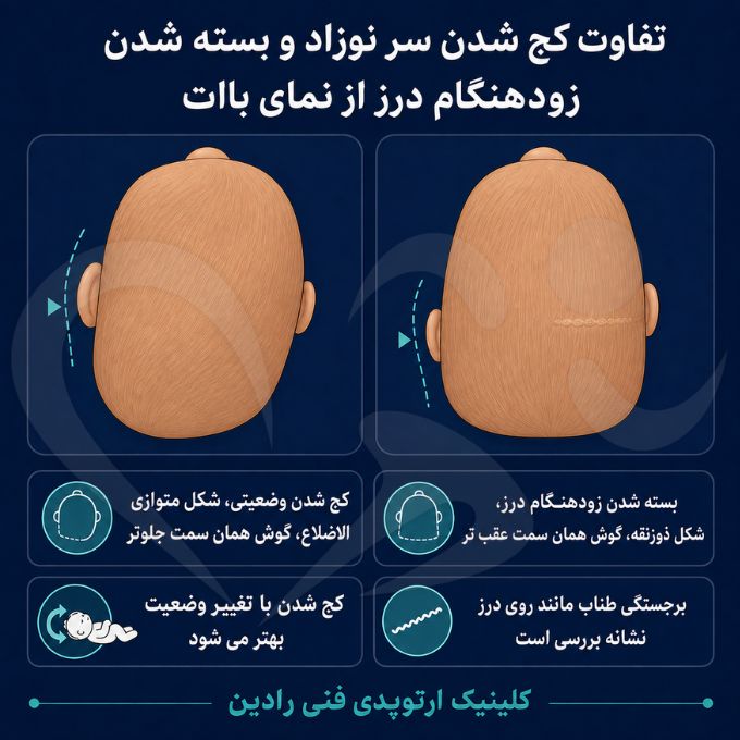 مقایسه کج شدن سر نوزاد با بسته شدن زودهنگام درز جمجمه از نمای بالا