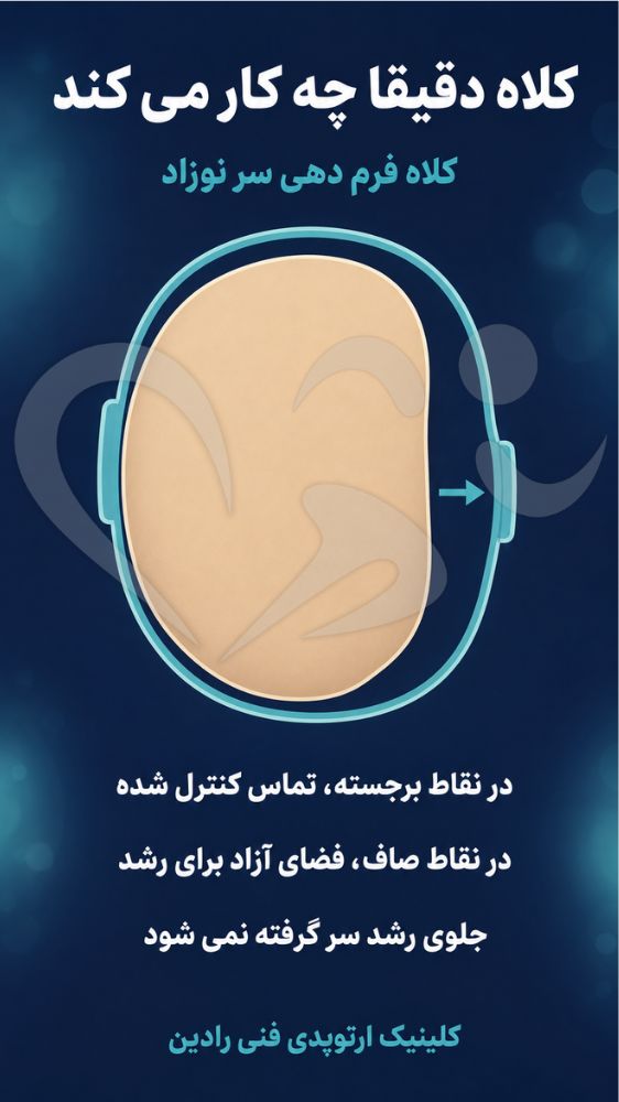 کلاه فرم دهی سر نوزاد در نقاط برجسته تماس دارد و در نقاط صاف فضای رشد می گذارد