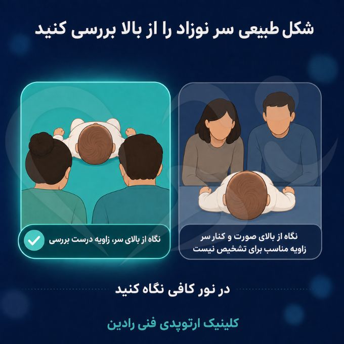 زاویه درست بررسی شکل طبیعی سر نوزاد در خانه، نگاه از بالای سر