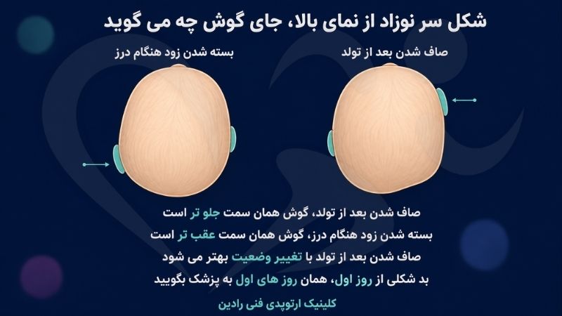 تفاوت صاف شدن سر بعد از تولد با بسته شدن زود هنگام درز