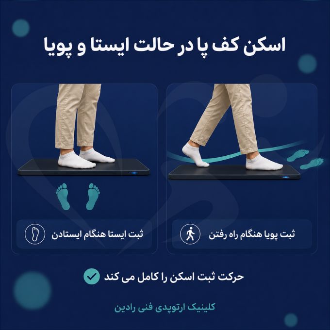 اسکن کف پا در حالت ایستادن و راه رفتن روی دستگاه